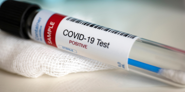 CPI vota requerimentos e ouve médicos favoráveis a ‘tratamento precoce’ nesta sexta