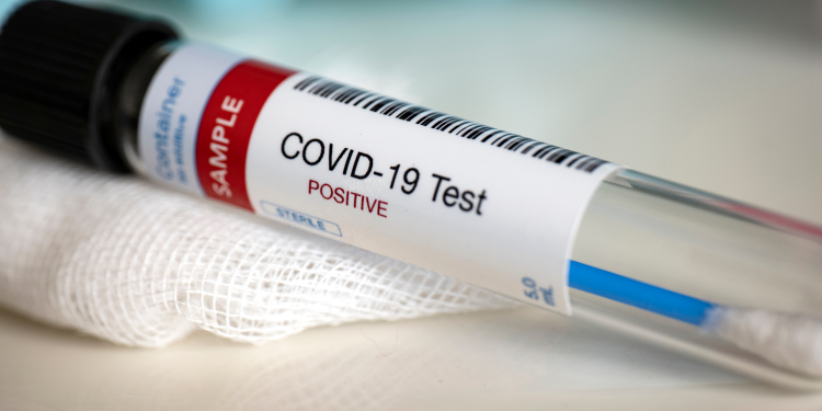 CPI vota requerimentos e ouve médicos favoráveis a ‘tratamento precoce’ nesta sexta