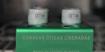 Curitiba reativa único banco multitecidos do país e volta a se destacar em transplantes