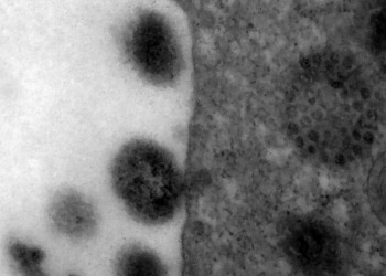 Covid-19: anticorpos podem durar até 12 meses após infecção