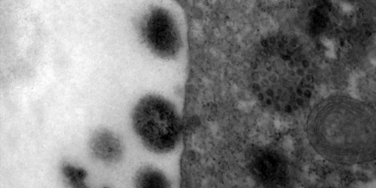 Covid-19: anticorpos podem durar até 12 meses após infecção