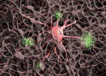 Covid-19 pode acelerar doença de Alzheimer, aponta estudo