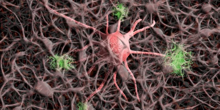 Covid-19 pode acelerar doença de Alzheimer, aponta estudo