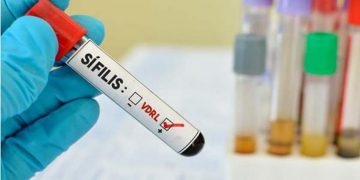 Em 11 anos, número de casos de sífilis no Brasil aumenta 16 vezes