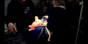 Bebê nasce empelicada e rompe bolsa com a própria mão, em Goiânia; vídeo