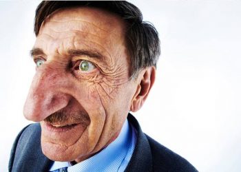 ‘Fui abençoado’, diz turco com o maior nariz do mundo segundo livro dos recordes