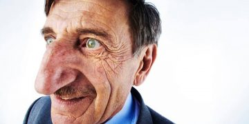 ‘Fui abençoado’, diz turco com o maior nariz do mundo segundo livro dos recordes