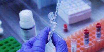 O que se sabe sobre os primeiros casos confirmados da variante Ômicron no Brasil