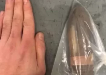 Homem com projétil de canhão no reto faz hospital acionar equipe antibomba