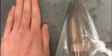 Homem com projétil de canhão no reto faz hospital acionar equipe antibomba