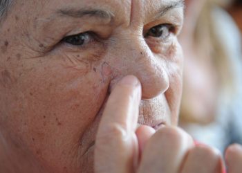 Dificuldade para se bronzear indica predisposição ao câncer de pele
