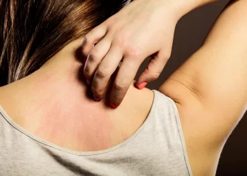 Surto de lesões que provocam coceira tem mariposas como causa, afirma Sociedade Brasileira de Dermatologia
