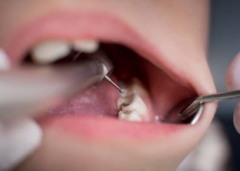 Criança morre durante consulta no dentista em Minas Gerais