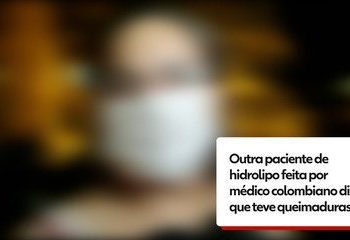 Hidrolipo está matando no Brasil. Paciente de médico colombiano relata queimaduras após hidrolipo no Rio: ‘Não deu importância’