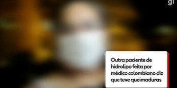 Hidrolipo está matando no Brasil. Paciente de médico colombiano relata queimaduras após hidrolipo no Rio: ‘Não deu importância’