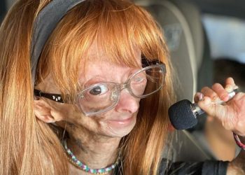 Morre aos 15 anos Adalia Rose, youtuber com ‘síndrome de Benjamin Button’ que tinha milhões de seguidores