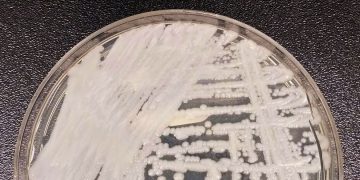 Entenda por que a Candida auris foi apelidada de superfungo