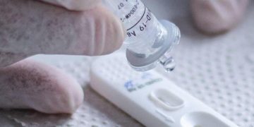 Afastamento de trabalhador por Covid cai para 10 dias