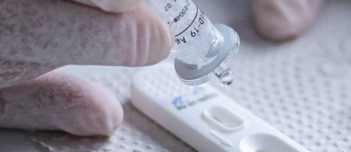 Afastamento de trabalhador por Covid cai para 10 dias