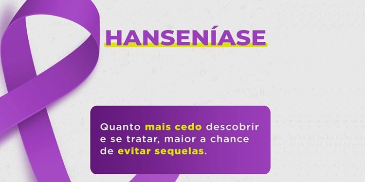 Campanha Janeiro Roxo: Precisamos falar sobre Hanseníase