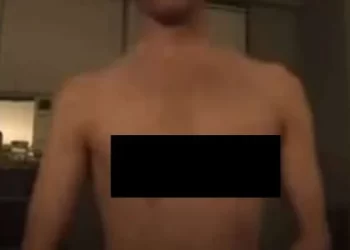 Um adolescente de 15 anos perdeu os dois mamilos, ao participar do “desafio do desodorante’’ pela internet. Ele despejou duas latas de spray do produto no peito.