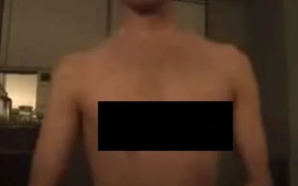 Um adolescente de 15 anos perdeu os dois mamilos, ao participar do “desafio do desodorante’’ pela internet. Ele despejou duas latas de spray do produto no peito.