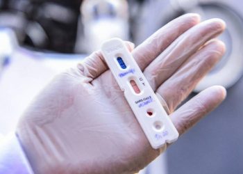 Procon realiza nova pesquisa de preços de testes de Covid-19 em Guarapuava