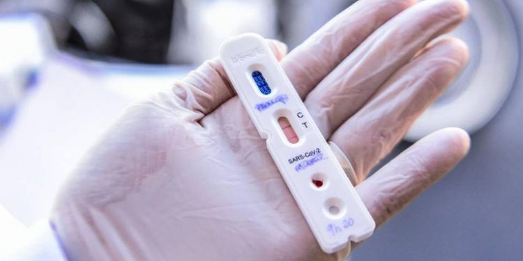 Procon realiza nova pesquisa de preços de testes de Covid-19 em Guarapuava