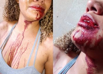 PM dá soco na boca de mulher durante confusão após abordagem em São Sebastião, no DF; veja vídeo
