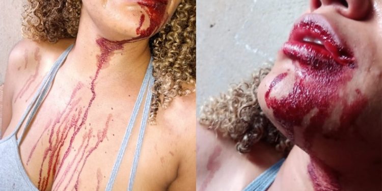 PM dá soco na boca de mulher durante confusão após abordagem em São Sebastião, no DF; veja vídeo