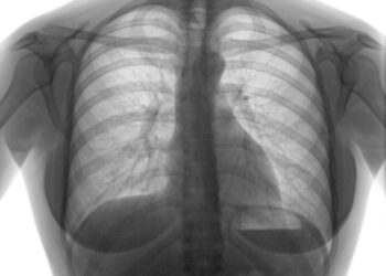 Prefeitura promove ações de prevenção contra a tuberculose