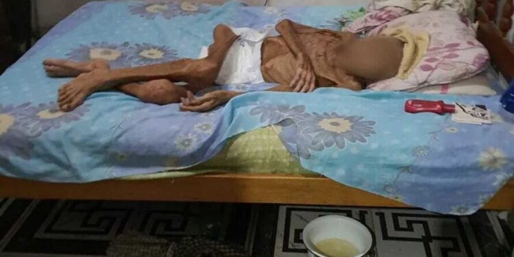 Morre idoso que foi mantido em cárcere privado pelos filhos