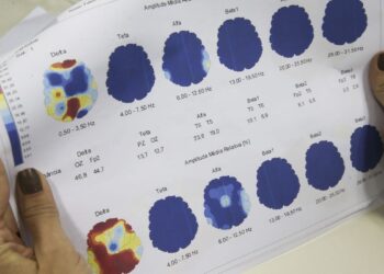 Março Roxo quer conscientizar população sobre a epilepsia