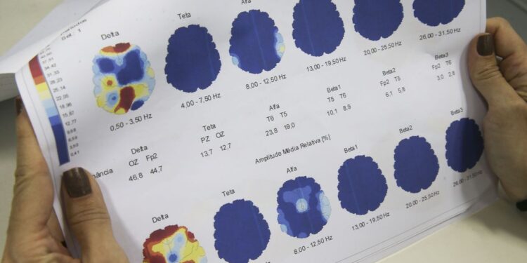Março Roxo quer conscientizar população sobre a epilepsia