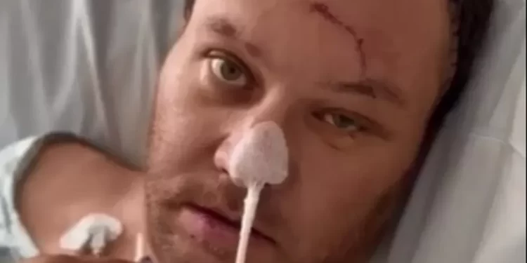 Prefeito atropelado em briga de futebol deixa UTI e grava vídeo: ‘Obrigado pela preocupação’