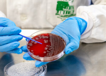 “Alerta em Saúde: Paraná Registra 389 Mil Casos de Doenças Gastrointestinais e Intensifica Campanha de Prevenção”