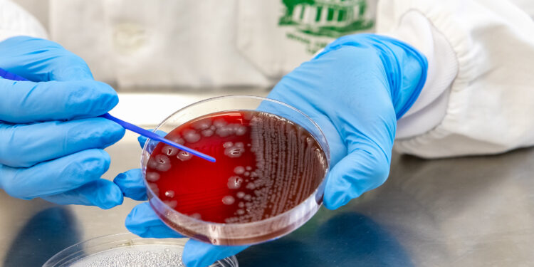 “Alerta em Saúde: Paraná Registra 389 Mil Casos de Doenças Gastrointestinais e Intensifica Campanha de Prevenção”