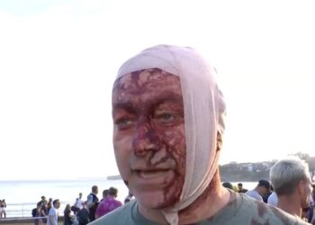 Ataque em Celebração Judaica na Praia de Bondi: Testemunhas Relatam Caos e Luto na Austrália