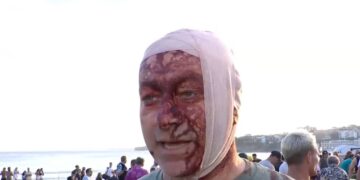 Ataque em Celebração Judaica na Praia de Bondi: Testemunhas Relatam Caos e Luto na Austrália