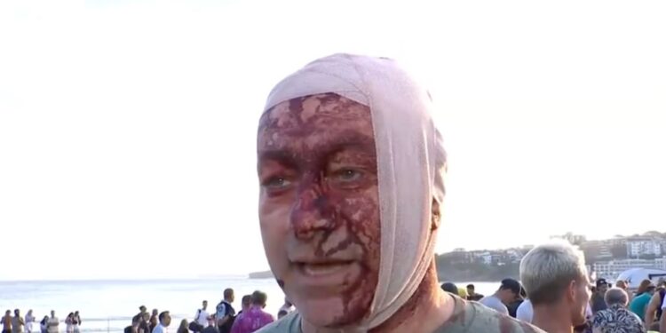 Ataque em Celebração Judaica na Praia de Bondi: Testemunhas Relatam Caos e Luto na Austrália