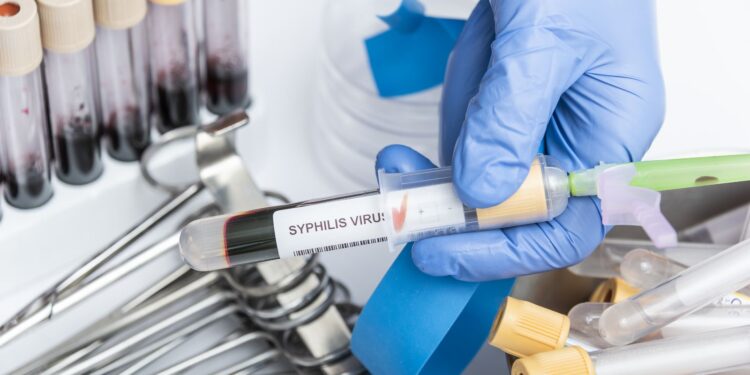 Sífilis em Ascensão no Brasil: Epidemia Silenciosa Ameaça Gestantes e Jovens
